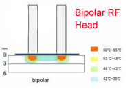 Elight + máquina bipolar da remoção do cabelo do RF com clarea a pele do corpo